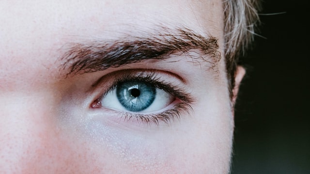 rarest eye colour