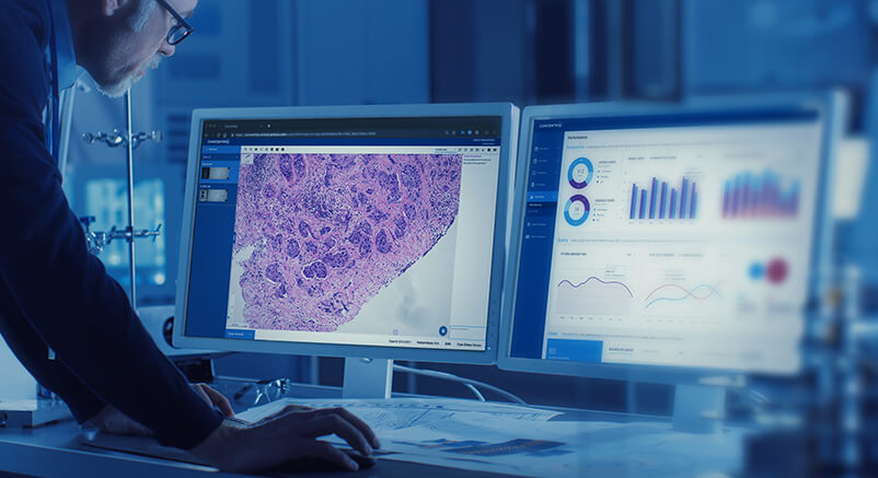 Global Digital Pathology Market